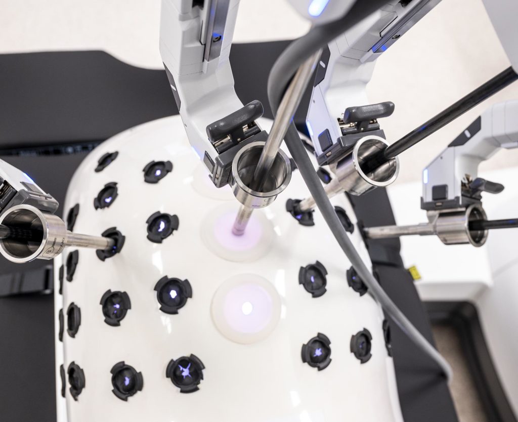 OP-Roboter von oben