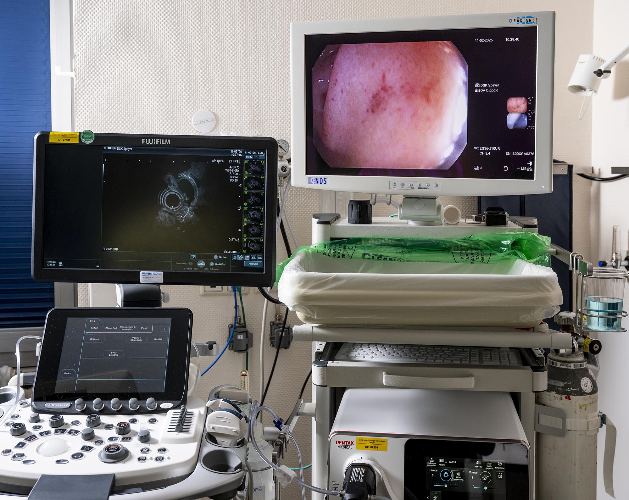 Endoskopisches Gerät, mit dem während der Durchführung von Endoskopien auch Ultraschallaufnahmen gemacht werden können