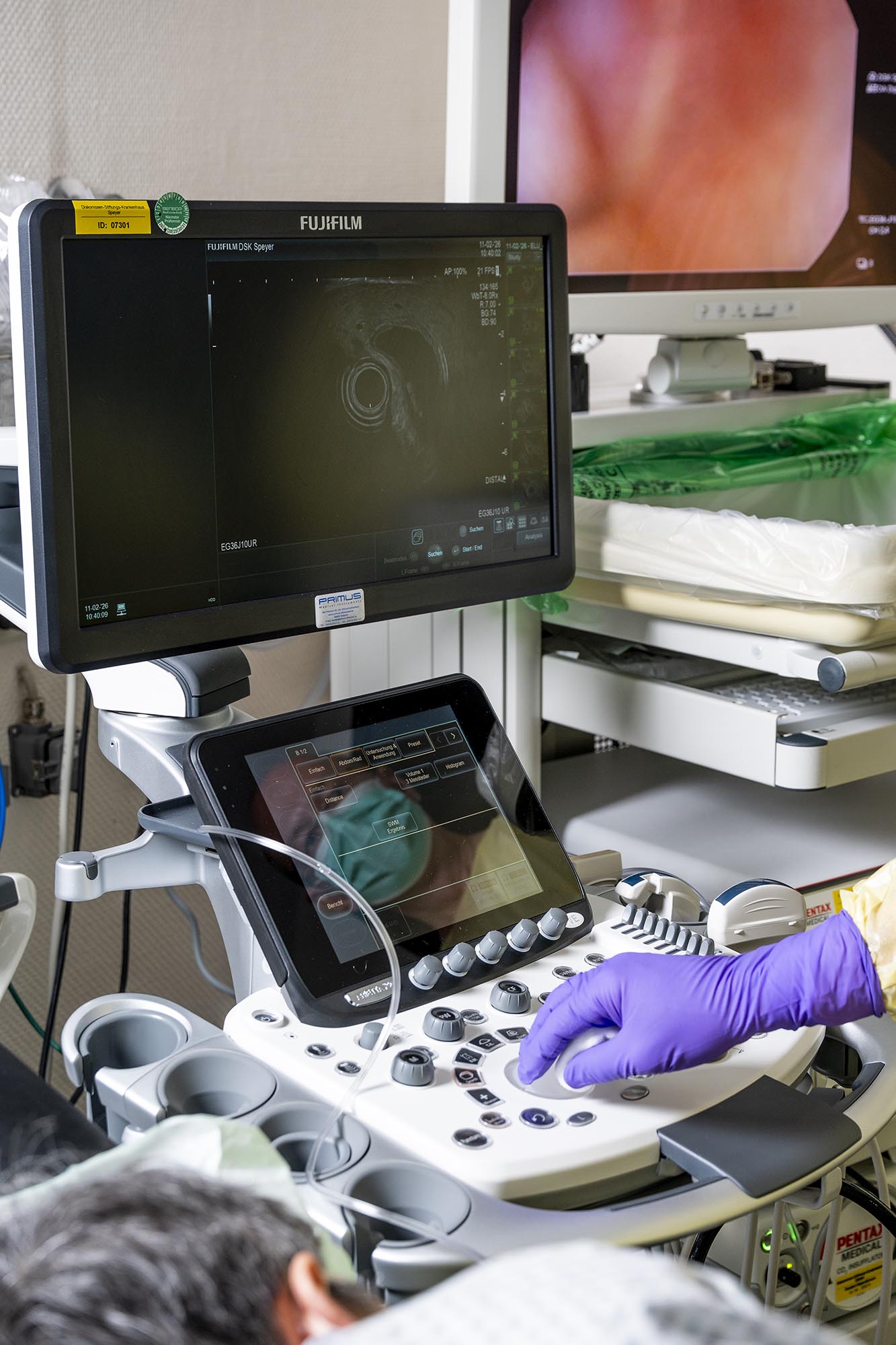 Eine gummibehandschuhte Hand bedient ein elektronisches Ultraschallgerät, im Hintergrund sieht man das endoskopische Bild und im Vordergrund liegt ein Patient auf dem Bauch